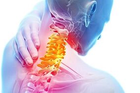 Sintomas de osteocondrose cervical e regras nutricionais para doenças